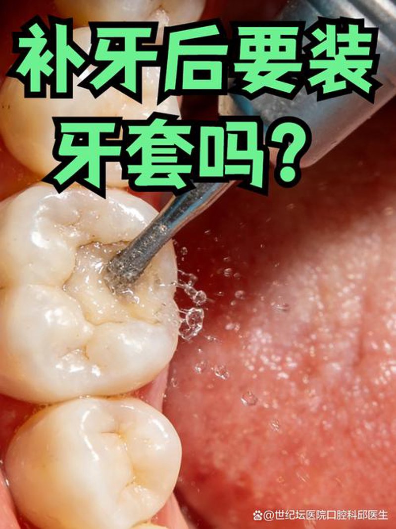 矫正牙齿的误区:拨开云雾见青天