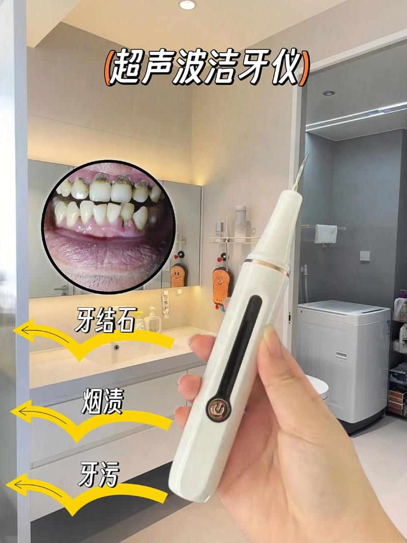 矫正牙齿，重塑自信笑容的神奇之旅